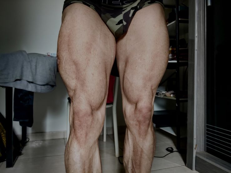 leg